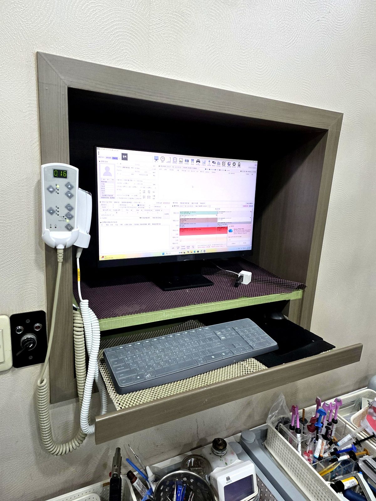 효치과 진료실 모니터